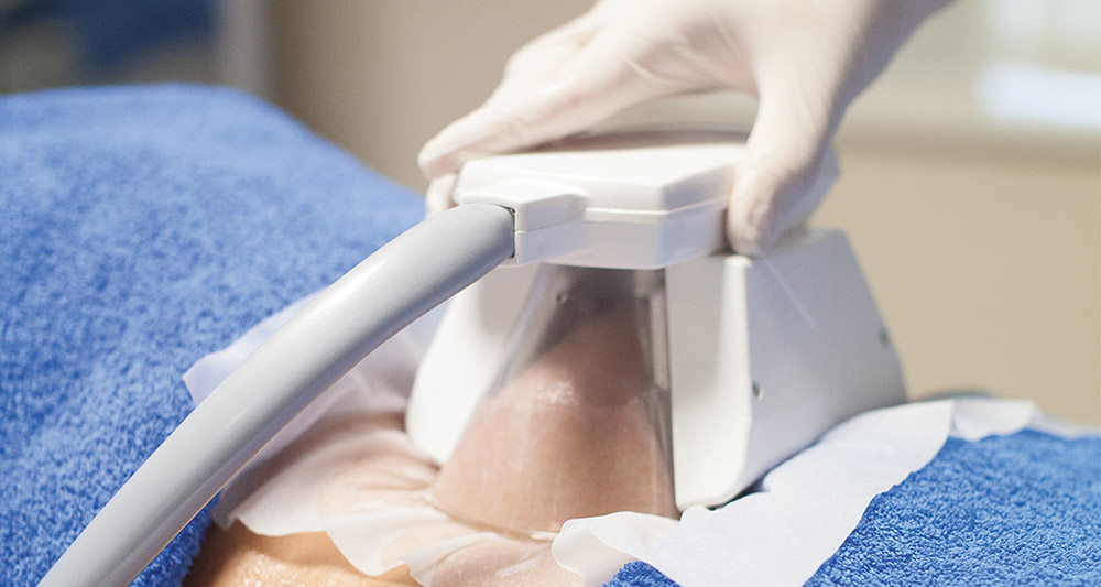 How Fat Freezing and HIFU Work Together? 2 Multiple Areas in One Session HIFU and Fat Freezing Bexhill
