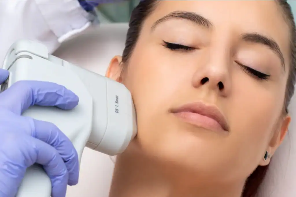 Discover the Perfect Duo: RF Microneedling and HIFU 2 Image of Morpheus8 And HIFU Combined with Lipo 360 Bexhill